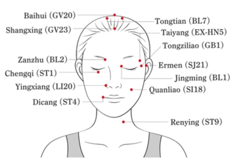 lidylle TCM acupuncture facial cosmetic course