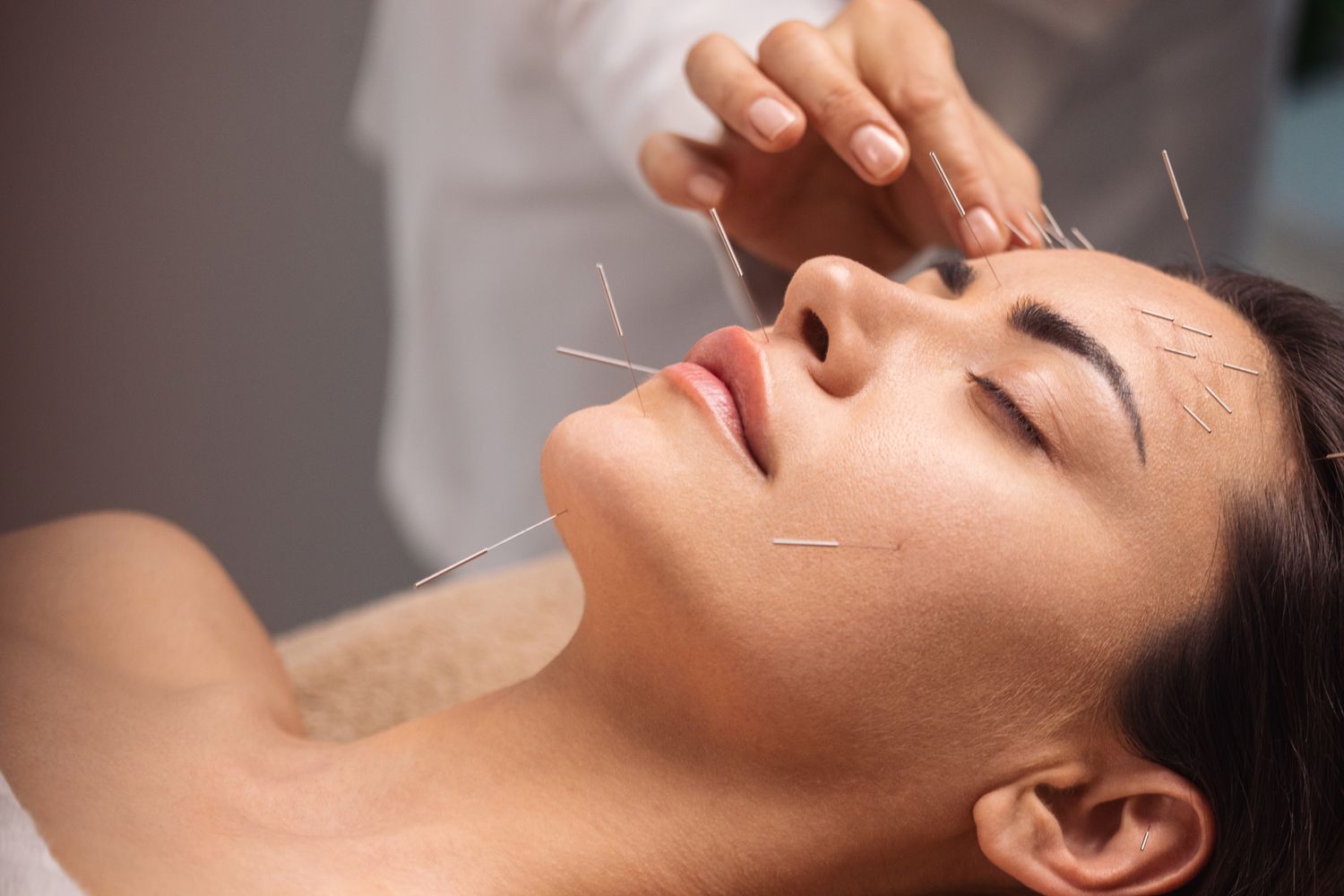 lidylle academy course facial-rejuvenation-cosmetic-acupuncture