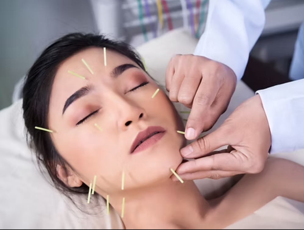 lidylle beauty academy cosmetic acupuncture facial course