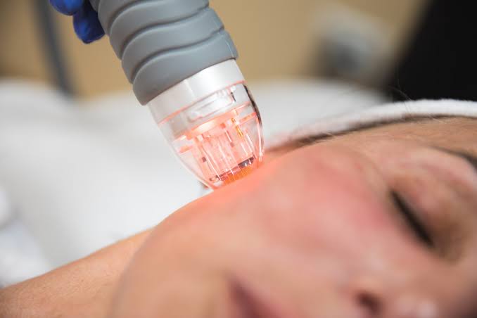 lidylle microneedling training international ceertificate malaysia kuala lumpur academy