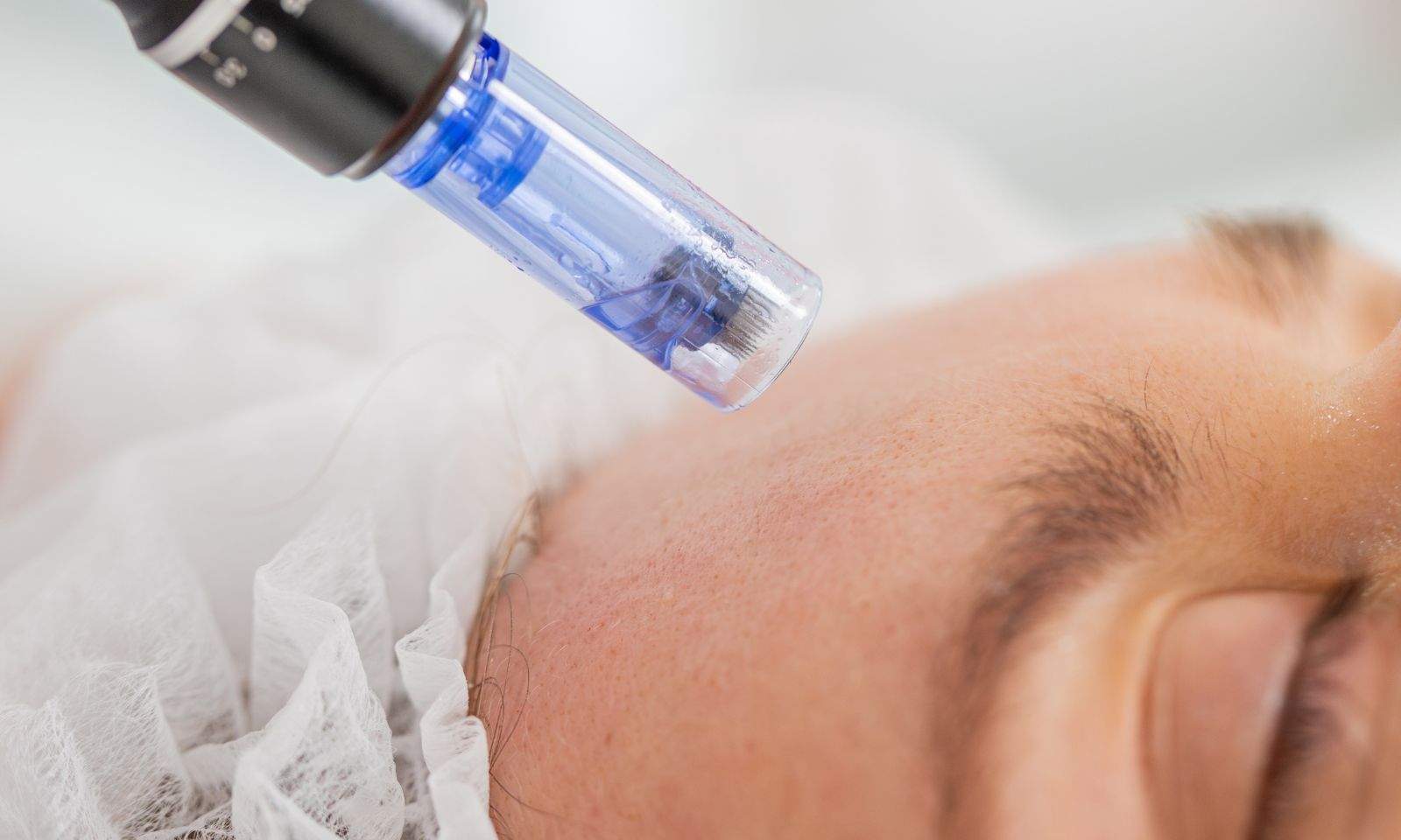 lidylle microneedling training international ceertificate malaysia